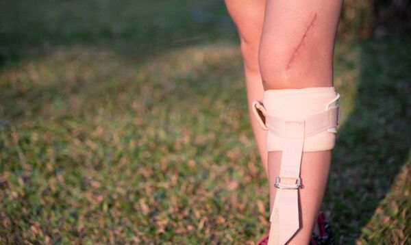 Wiederherstellung der Beine nach einer Operation bei Krampfadern