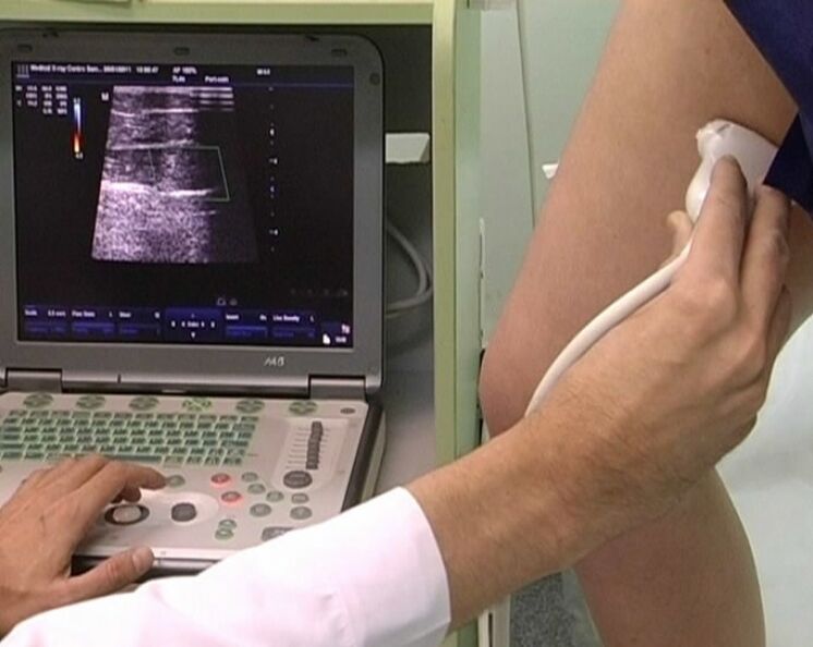 Ultraschalldiagnostik von Beckenkrampfadern