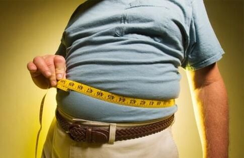 Übergewicht provoziert die Entwicklung von Krampfadern